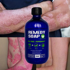 Organic Tea Tree Body Wash Soothes Itchy Skin, Nourishes & Heals