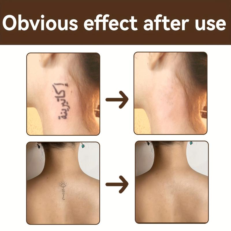 Acne Mark Concealer Liquid Dark Circle Spot Tattoo Scar Cover