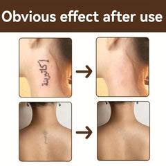 Acne Mark Concealer Liquid Dark Circle Spot Tattoo Scar Cover