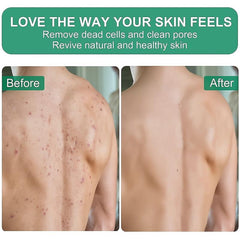 Exfoliating Mitts 150D Material for Smooth Exfoliation