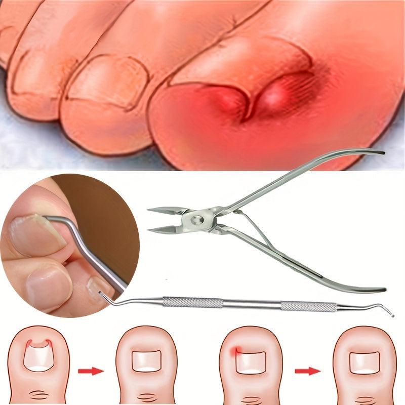 Ingrown Toe Nail Correction Nippers Clipper Cutters Pedicure Care Tool
