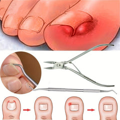Ingrown Toe Nail Correction Nippers Clipper Cutters Pedicure Care Tool