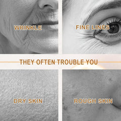 20pcs Collagen Moisturizing Mask Tightens Facial Nasolabial Lines