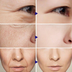 10Pcs Collagen Smile Line Patch For Facial Smile Line Lifting