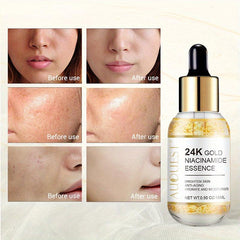 24K Golden Niacinamide Essence Facial Serum - Anti-Aging Solution