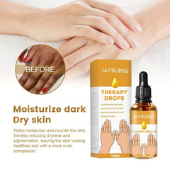 Acanthopanax Essence Hand Joint Skin Illuminating Essence