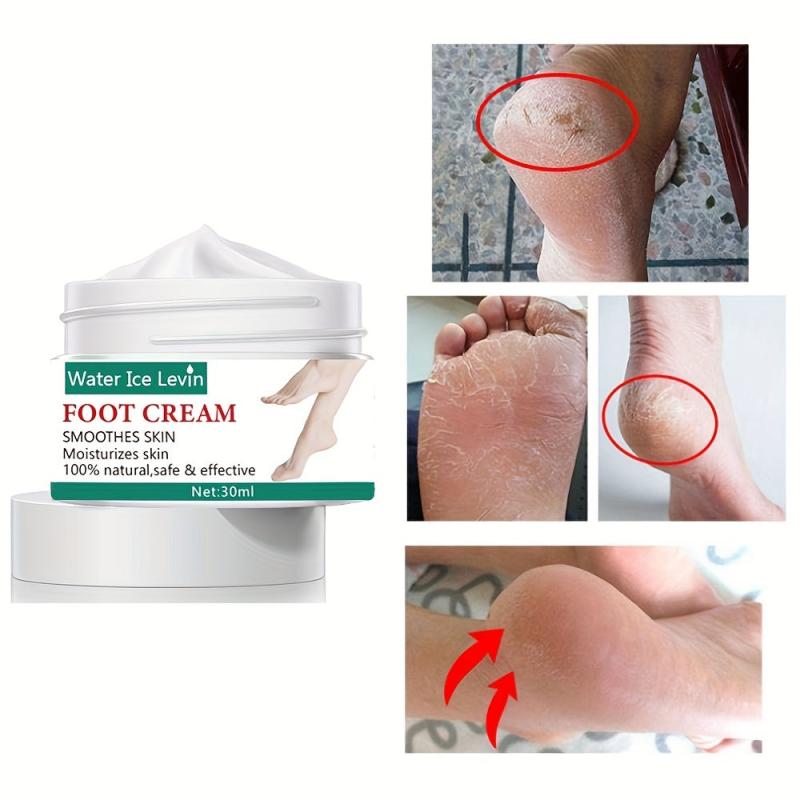 Heel & Foot Cream: Moisturize, Prevent Dry & Cracked Heels