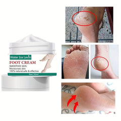 Heel & Foot Cream: Moisturize, Prevent Dry & Cracked Heels