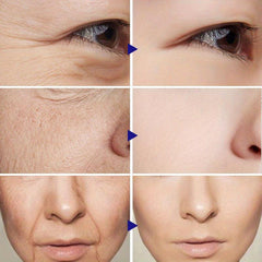 10Pcs Collagen Smile Line Patch For Firming Skin
