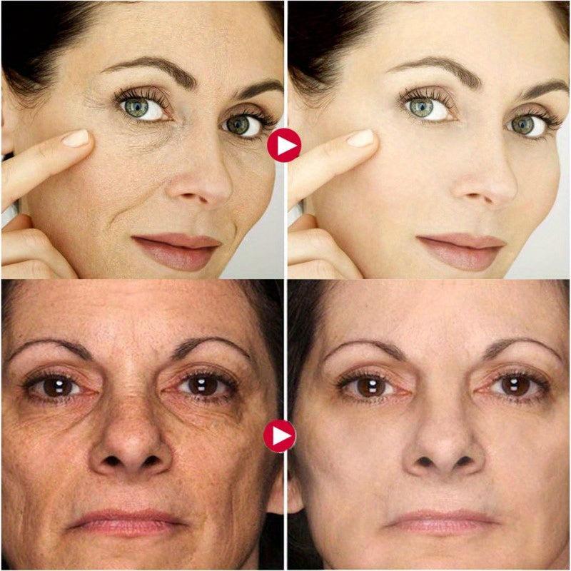 10Pcs Collagen Smile Line Patch For Firming Skin