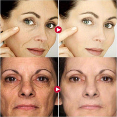 10Pcs Collagen Smile Line Patch For Firming Skin