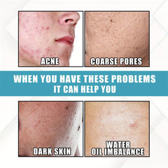 60 Men's Salicylic Acid Pads for Acne Control & Pore Shrinkage