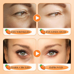 20g Eye Cream Smooth Fine Lines Anti-Aging Dark Circle Treatment