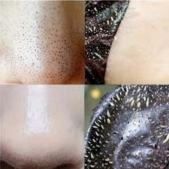100Pcs Blackhead Remover Nose Strips Deep Cleansing Head Mask
