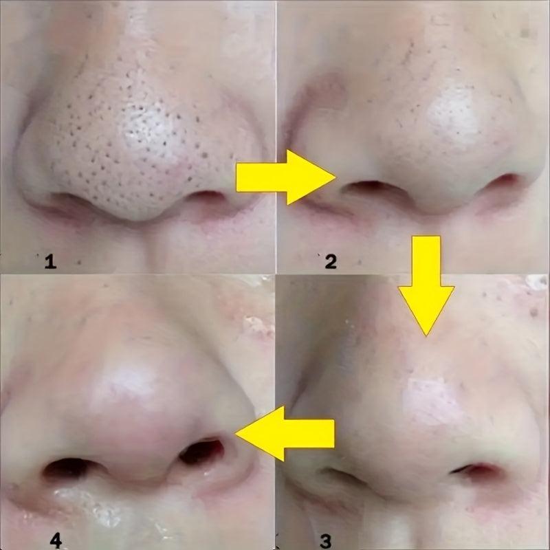 100Pcs Blackhead Remover Nose Strips Deep Cleansing Head Mask