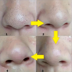 100Pcs Blackhead Remover Nose Strips Deep Cleansing Head Mask