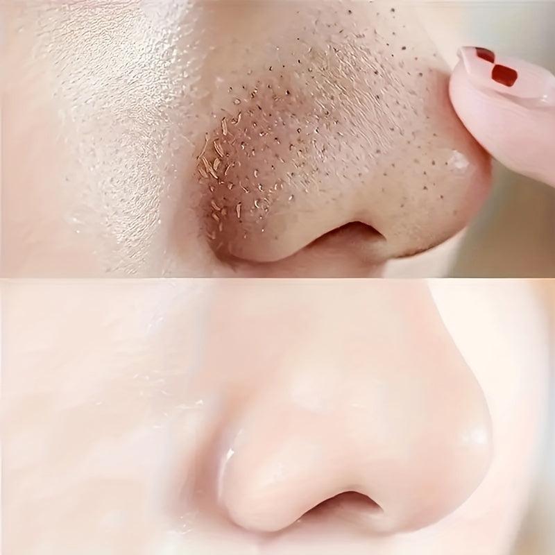 100Pcs Blackhead Remover Nose Strips Deep Cleansing Head Mask