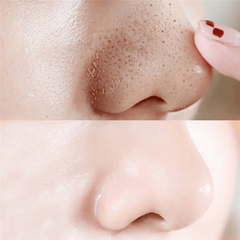 20 Pcs Nose Masks Deep Cleansing Shrink Pore Skin Care
