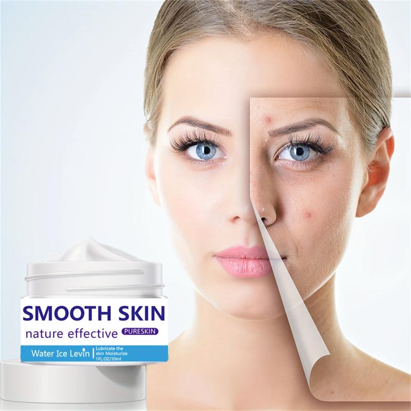 30ml Acne Removing Cream - Face Smoothing & Repairing