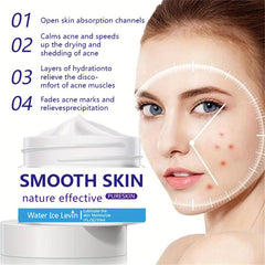 30ml Acne Removing Cream - Face Smoothing & Repairing
