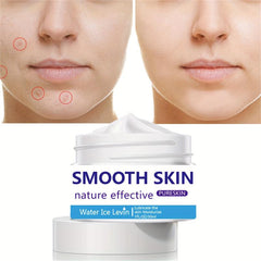30ml Acne Removing Cream - Face Smoothing & Repairing