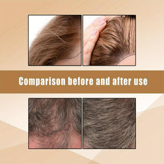 Ginger Shampoo Soap for Hair Growth Thickening Moisturizing Scalp Massage