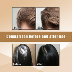 Ginger Shampoo Soap for Hair Growth Thickening Moisturizing Scalp Massage