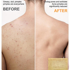 Men's Exfoliating Scrub Bar 3-In-1 Cleanser For Body Face Shaving