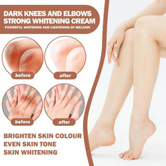 Body Brightening Cream Lightens Dullness Moisturizes Elbows
