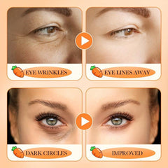 20g Carrot Eye Cream for Dry Eye Lines, Moisturizing and Skin Rejuvenation