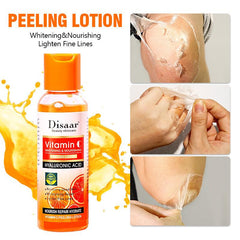 Vitamin C Exfoliating Lotion for Elbows, Knees, Finger Joints