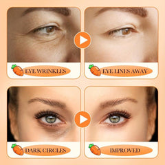 Carotene Eye Cream 20g Moisturizes & Improves Dark Circles Eye Wrinkles Eye Bags