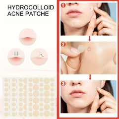 144pcs Acne Covering Patches for Daily & Night Skin Care
