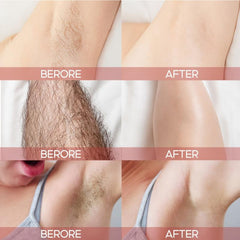 50ml Peach Hair Removal Cream For Women - Effective Hair Removal in 8 Minutes