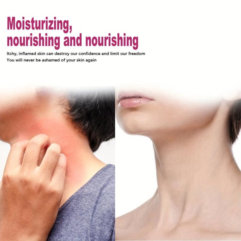30g Cream For Itchy Skin Moisturizing Rejuvenating Skin