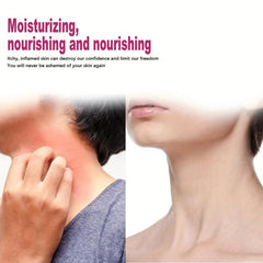 30g Cream For Itchy Skin Moisturizing Rejuvenating Skin