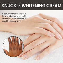 Joint Beauty Brightening Cream Elbow Whitening Hydrating