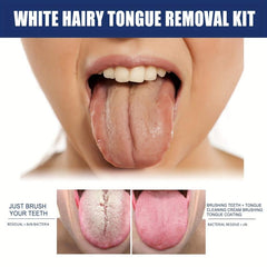 Tongue Cleaning Set Deodorization Fresh Breath Tongue Brush