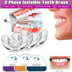 3 Stages Dental Orthodontic Braces Teeth Straightener For Home Use