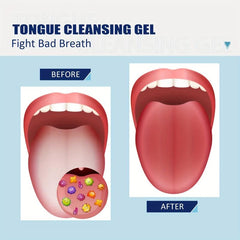 Minty Silicone Tongue Cleaning Gel Fresh Breath Oral Care