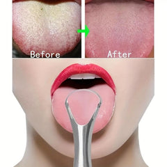 1Pcs Tongue Scraper Reduce Bad Breath Oral Care Stainless Steel Mental Cleaners
