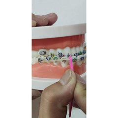 15pcs Dental Rubber Bands Placers Disposable For Braces