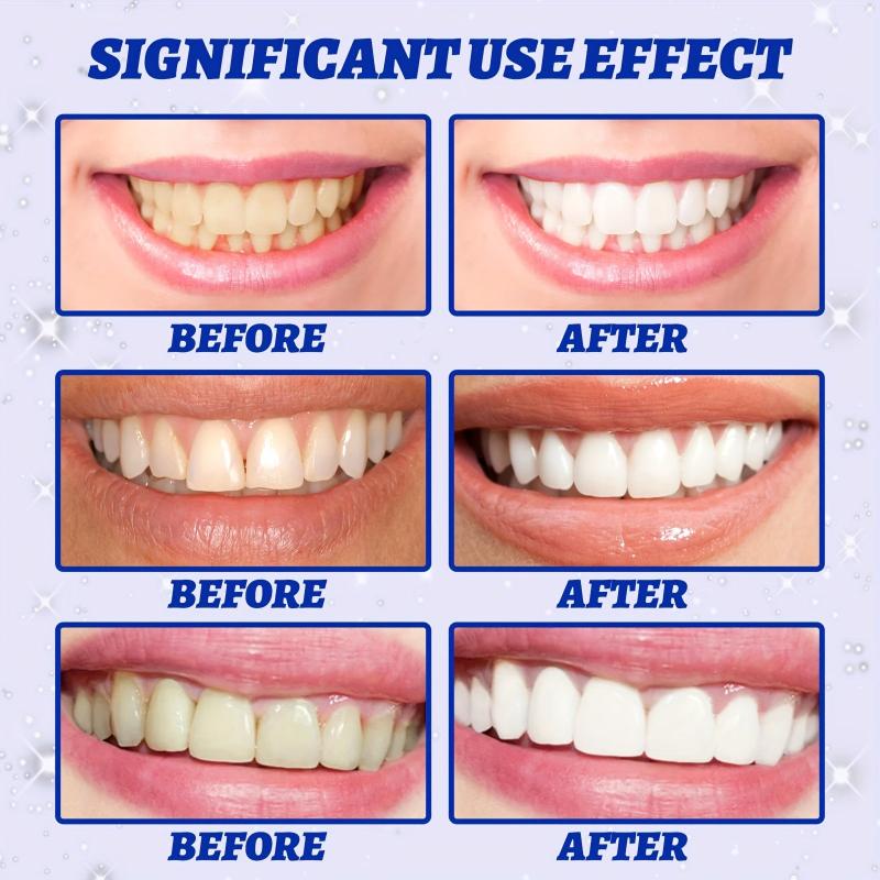 Teeth Whitening Strips Non Sensitive Tooth Bleaching Brightening Strips