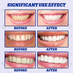 Teeth Whitening Strips Non Sensitive Tooth Bleaching Brightening Strips