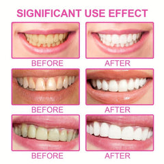 Teeth Whitening Strips Non Sensitive Set - Brighten & Bleach Teeth