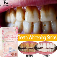Teeth Whitening Strips Non Sensitive Set - Brighten & Bleach Teeth