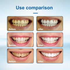 30ml Teeth Whitening Essence Corrector Serum For Brightening Tooth