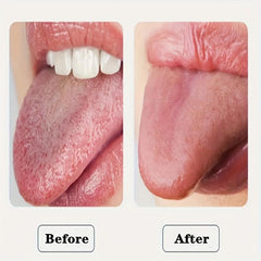Stainless Steel Tongue Scraper for Bad Breath Oral Care