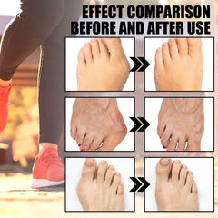 Foot Heel Care Socks - Warm and Breathable Foot Socks