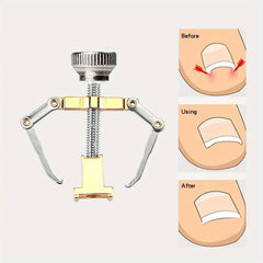 2Pcs Ingrown Toenail Protector Pedicure Tool Stainless Steel Foot Care